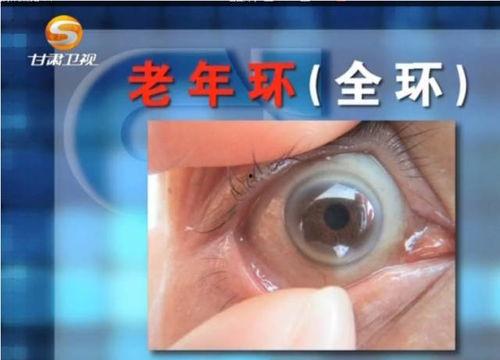 成人眼球结构视频教学,成人眼球结构概述