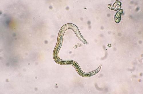 成人如何感染蛔虫呢视频,预防与应对策略