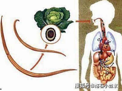 成人如何感染蛔虫呢视频,预防与应对策略