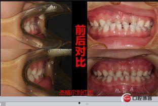 成人会有乳牙么吗视频