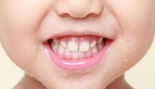 成人会有乳牙么吗视频  第3张